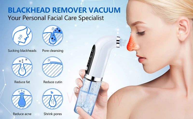 2025 Blackhead Remover Vacuum – Electric Pore Cleaner & Facial Device