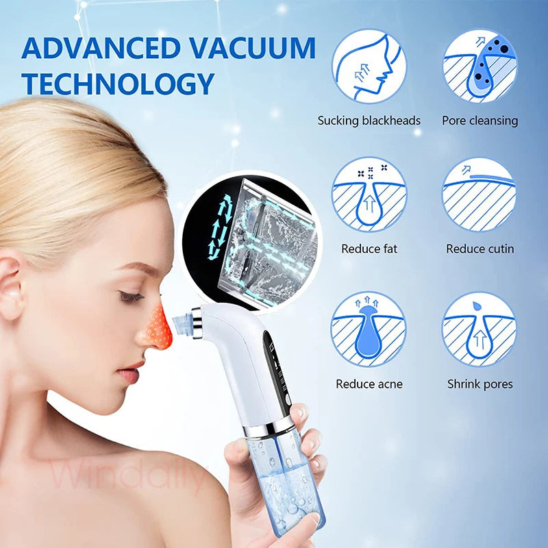 2025 Blackhead Remover Vacuum – Electric Pore Cleaner & Facial Device