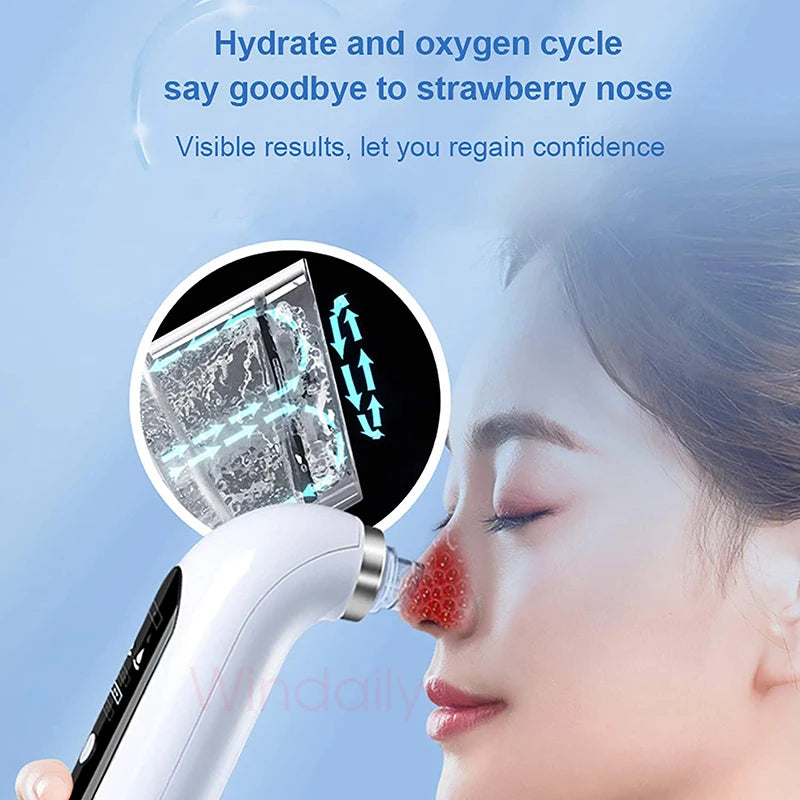 2025 Blackhead Remover Vacuum – Electric Pore Cleaner & Facial Device